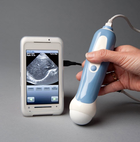 smart phone sonogram attachment