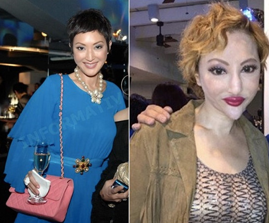 fanny sieh plastic surgery