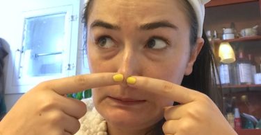 clogged pores on nose