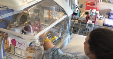 placenta accreta preemie in the nicu