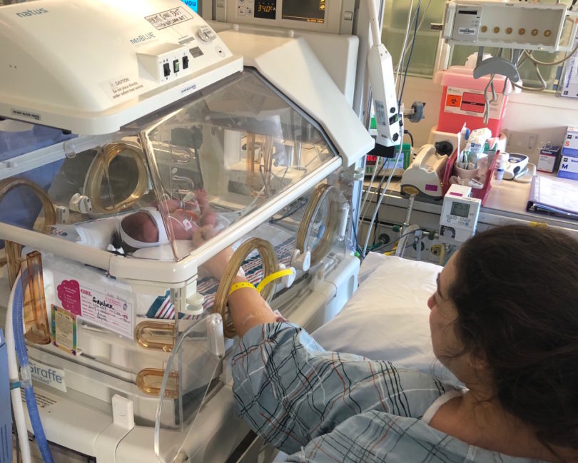 placenta accreta preemie in the nicu