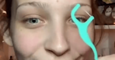 removing blackheads with dental floss